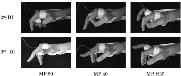 Figure 3. PIP joint extension angle during electrical stimulation of the 2 nd  and 3 rd  DI muscles (repre- (repre-sentative example).