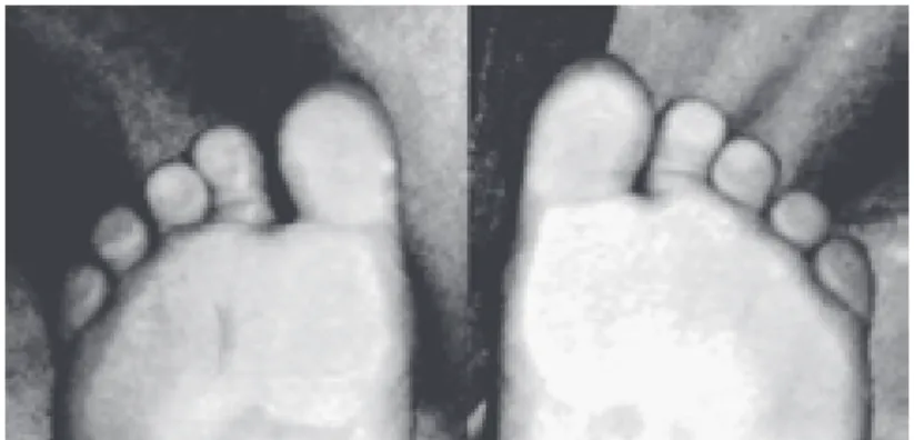 Figure 2. Arch pads