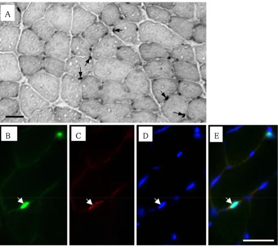 Fig  3  Photomicrographs  showing  localization  of  myogenin  on  day  1  after  overload