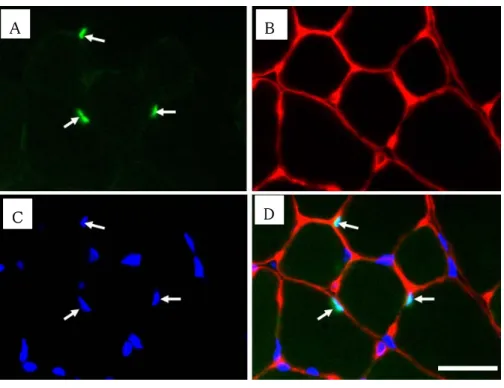 Fig 6 Photomicrographs showing localization of Pax 7 at day 1 after overload. Triple immunostaining to view  localization of Pax 7 (A), laminin (B) and nuclei (C) was performed and the three images were merged (D)