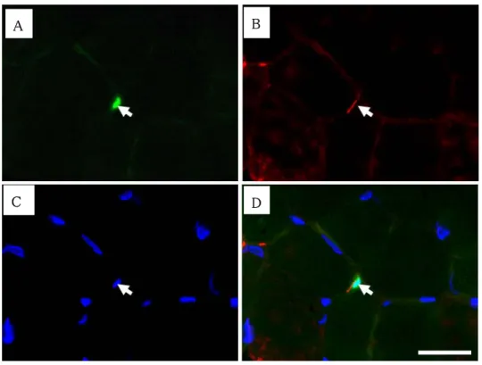 Fig 7 Photomicrographs showing localization of Pax 7 at day 1 after overload. Triple immunostaining to view  localization of Pax 7 (A), M-cadherin (B) and nuclei (C) was performed and the three images were merged  (D)