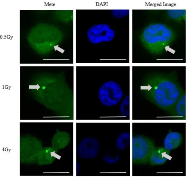図 12  各線量照射後における Mete 顆粒近傍における Mete-DAPI での共染色の 結果。上段は 0.5 Gy, 中段は 1 Gy, 下段は 4 Gy 照射時の結果である。Mete 顆粒 の位置は細胞質に存在することが確認できる。Scale bar は 20 ㎛を表す。 