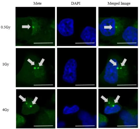 図 15  wt p53 H1299 での各線量照射後における Mete 顆粒近傍における Mete- Mete-DAPI での共染色の結果。上段は 0.5 Gy, 中段は 1 Gy, 下段は 4 Gy 照射時の結果 である。Mete 顆粒の位置は細胞質に存在することが確認できる。Scale bar は 20