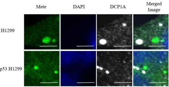 図 17  1 Gy 照射後における Mete 顆粒近傍での Mete-DAPI-Dcp1a での共染色の 結果。上段は H1299, 下段は wt-p53 H1299 細胞での結果を示す。図は 1 Gy 照射 後における Mete 顆粒近傍での Merged Image である。Scale bar は 5 ㎛を表す。 