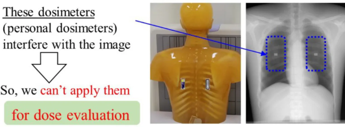 Fig. 1: Management of the exposure dose. For medical staff, personal dosimeters are generally used