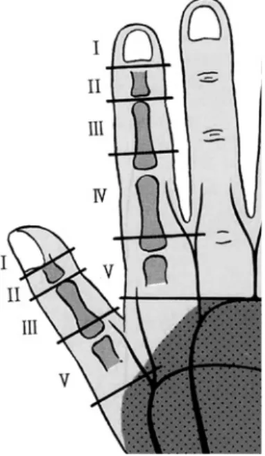 図 1 玉井分類による切断レベル