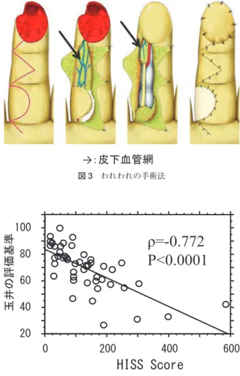 図 2 切断レベル