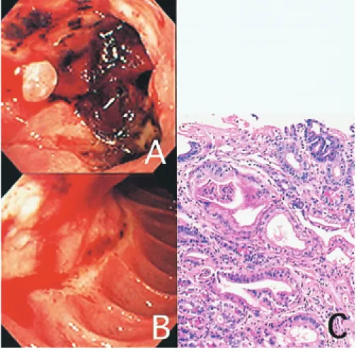 Fig. 3 Upper gastrointestinal endoscopy