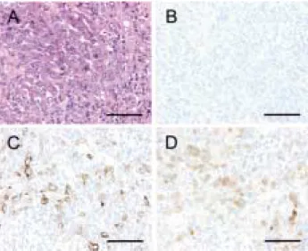 Table 1. Immunohistochemical data Marker Epithelioid mesothelioma