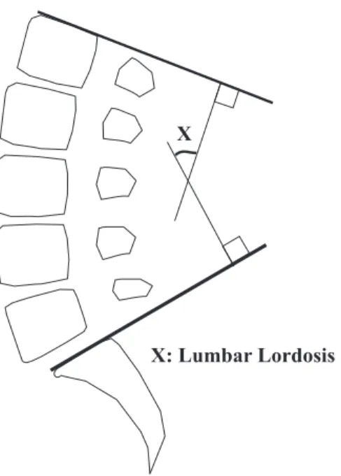 Figure 3. Lumbar lordosis was measured from the superior endplate of L1 to the superior endplate of S1.