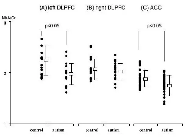 Table 1 Metabolite concentrations and ratios in autistic and control subjects