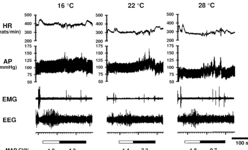Fig. 3. Representative recordings showing changes in heart rate (HR), arterial pressure (AP), electromyogram (EMG) and electroencephalogram (EEG) during successive non-REM (indicated by horizontal open columns at bottom) and REM (indicated by horizontal cl