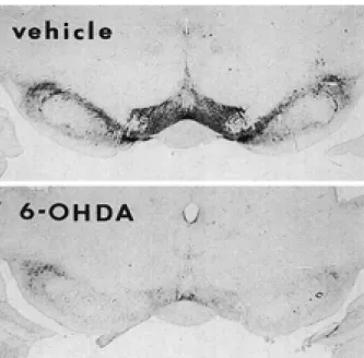 Fig. 4. Examples of brain sections near the injection site, pro- pro-cessed for tyrosine hydroxylase (TH) immunohistochemistry, in a 6-hydroxydopamine (6-OHDA)- and vehicle-treated rat