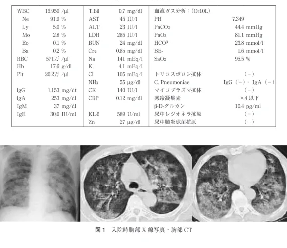 図 1  入院時胸部 X線写真・胸部 CT 図 2  入院後経過mEq/l4.1Kg/dl17.6Hb （－）トリコスポロン抗体mEq/l105Cl/μl20.2万PltIgG（－）・ I gA（－）C.Pneumoniaeμg/dl55NH3（－）マイコプラズマ抗体IU/l140CKmg/dt1,153lgG×4以下寒冷凝集素mg/dl0.12CRPmg/dl253lgApg/ml10.4β-D-グルカン　mg/dl37IgM（－）尿中レジオネラ抗原U/ml589KL-6IU/ml30.0IgE（－）尿中