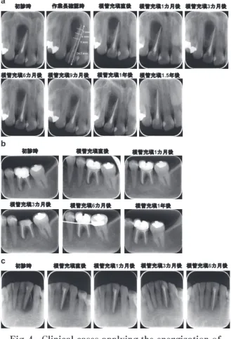 Fig.　₄　 Clinical cases applying the energization of  high frequency current