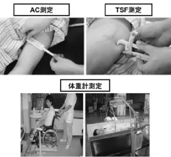 図 7 身体計測風景 表 1 口腔ケアチームのスケジュールを行ったうえで病棟回診（図 6）を行い，総合的に栄養管理を検討する．その結果を，主治医や病棟スタッフに，NST カルテを通じて報告し，症例に応じた適切な栄養管理を実施している．3．NST におけるリハ科の取り組みNST におけるリハ科の役割は，NST 回診，ランチタイム・ミーティングに参加し，リハビリの状況などを情報として伝えること，および栄養アセスメントに必要な情報のひとつである，身体計測を行うことである．計測の内容は，身長，体重，上腕周囲長（ar