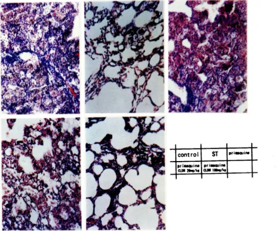 Fig.  6.  Histopathology  of  the  lungs 