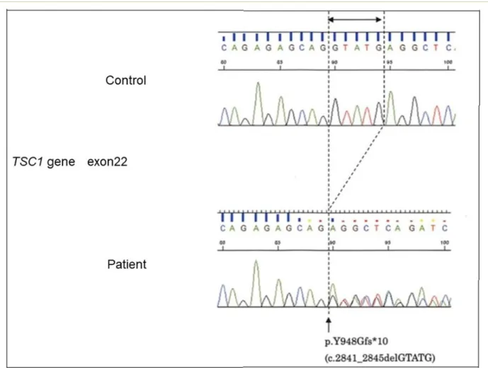 Figure  2.  Result  of  the  genomic  DNA  analysis  by  a  next-generation  sequencer,  MiSeq  with  TruSight  One Sequencing Panel (Illumina)