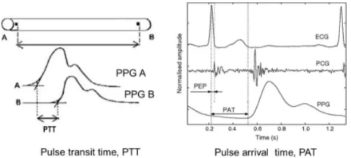 Fig. 1 Estimation of BP based on the PTT, which is calculated based on the PPG waveform and ECG R wave PCG is the phonocardiograph signal.