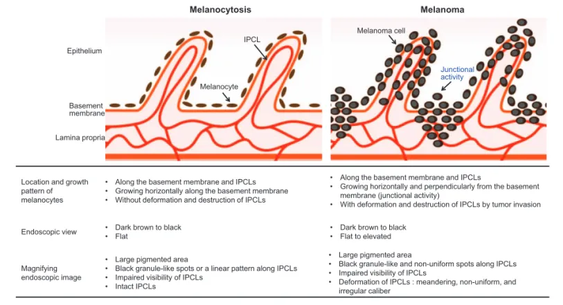 Figure 3 shows schemata and endoscopic, histological ﬁndings of melanocytosis and PMME