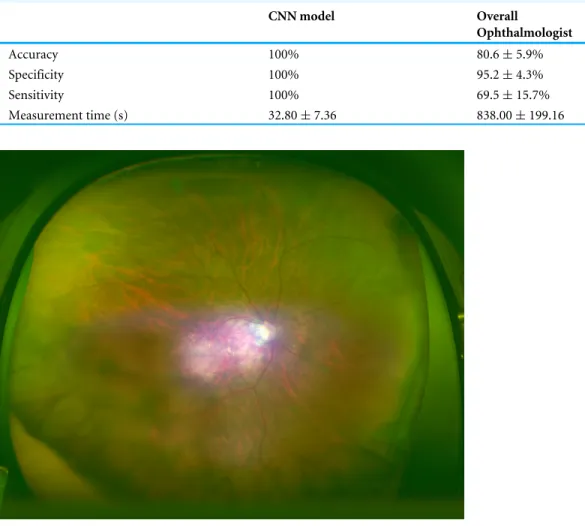 Table 2 The results of CNN model and overall ophthalmologist. The convolutional neural network model, discrimination test of the macular holes data and the normal data, ophthalmologist, accuracy,  sen-sitivity, specificity, and measurement time.