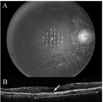 Figure 5. Correlation between the length of the photoreceptor inner/outer segment (IS/OS) junction and the retinal sensitivity.