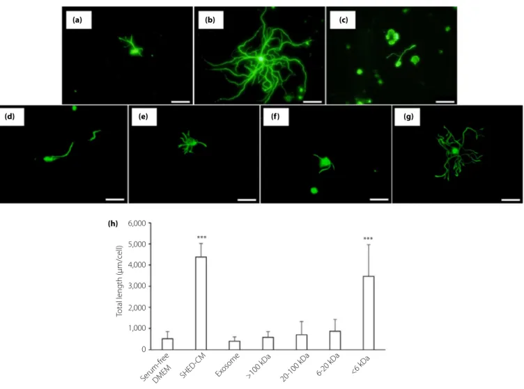 Figure 1 | Neurite outgrowth of dorsal root ganglion (DRG) neurons. DRG neurons were cultured with (a) Dulbecco's modified Eagle's medium (DMEM), (b) conditioned medium of stem cells from human exfoliated deciduous teeth (SHED-CM), (c) exosome, and SHED-CM