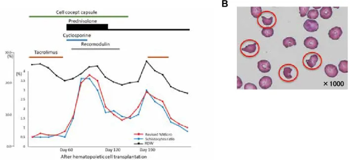 Fig 5. 　Representative patient data. A. A case of acute myeloid leukemia in a patient harboring the inv (16) (p13.1q22) mutation  ( CBFB-MYH11  translocation)