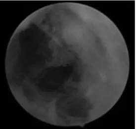 Fig 2. 　Initial image of the lumbar spine