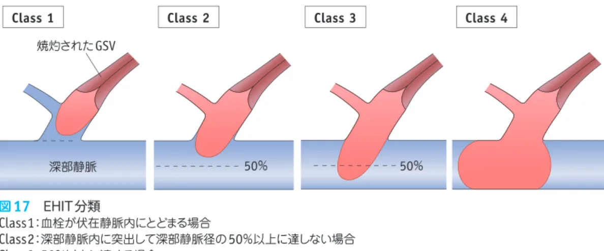 図 18   EHIT Class3の超音波検査所見