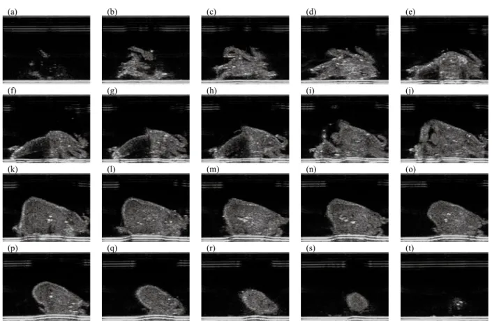 Figure 1   Tomographic image of oyster by ultrasonic sonograph.