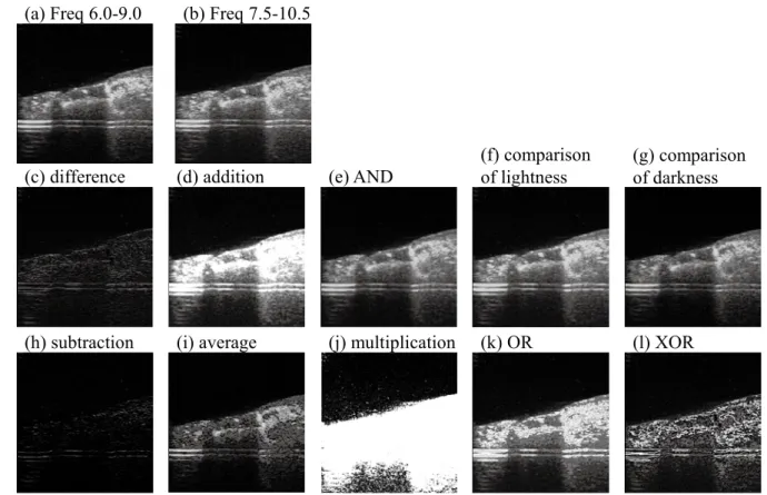 Figure 3   Adductor muscle detection by image processing of oyster tomographic image.