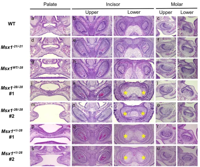 Figure 3.  Coronal sections of Msx1 mutant mice at E16.5. Samples are stained with hematoxylin and eosin
