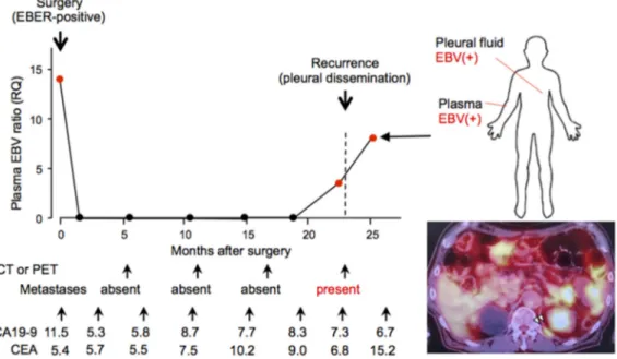 Figure 2: Dynamics of the plasma Epstein-Barr virus (EBV) ratio before and after surgery