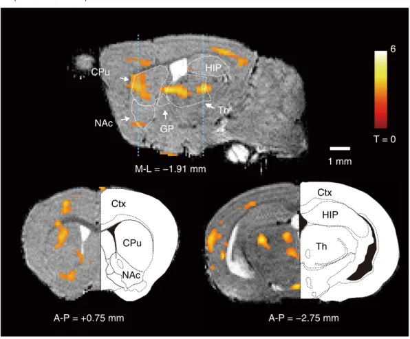 Figure 2.  The active regions in PD compared with control mice quantified by qAIM-MRI