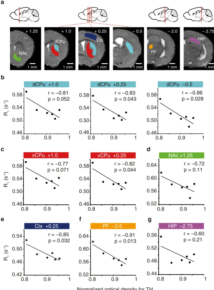 Figure 4.  R 1  in CPu represents the severity of PD. (a) ROIs were defined by brain atlas alignments to MRI  images