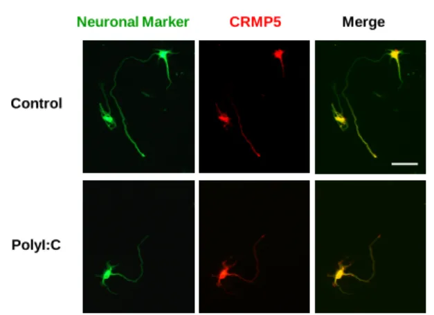 Fig. 4. Effect of polyI:C treatment on the expression level of ALDH1L1 mRNA in primary cultured astrocyte