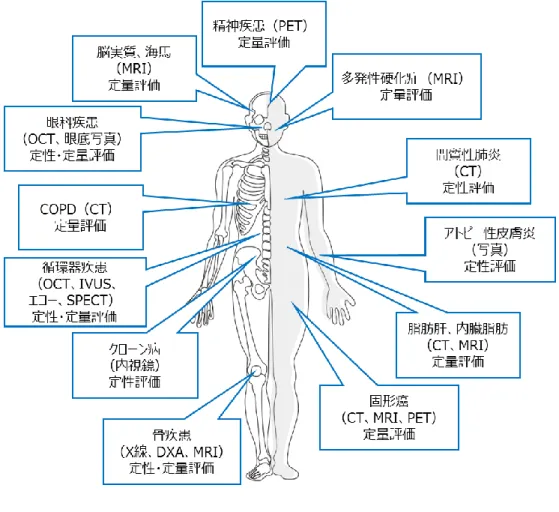 Figure 1. 臨床試験で用いられるモダリティと疾患例 