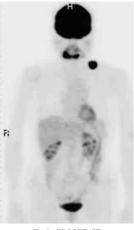 Fig. 5 FDG-PET/CT