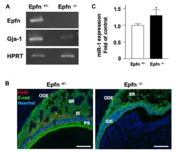 FIGURE 6 | Proposed model of the regulatory mechanism in ameloblasts by miR-1-mediated Cx43 expression during dental epithelial cell differentiation.