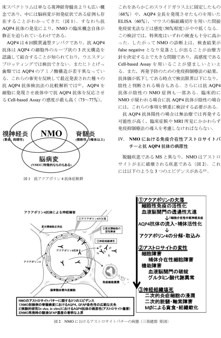 図 1 抗アクアポリン 4 抗体症候群 図 2 NMO におけるアストロサイトパチーの病態 (三須建郎 原図)床スペクトラムは単なる視神経脊髄炎よりも広い概念であり，中には脳病変が初発症状である症例も存在することがわかってきた（図1）．すなわち抗AQP4抗体の発見により，NMOの臨床概念自体が修正を迫られているわけである．AQP4は6回膜貫通型タンパクであり，抗AQP4抗体はAQP4の細胞外のループ状の3次元構造を認識して結合することが知られており，ウエスタンブロッティングでは検出できない．またヒトとげっ歯