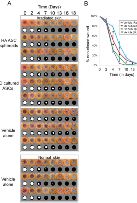 Figure 5.  Macroscopic evaluation of wound healing in irradiated tissue of nude mice. (A) Sequential views of  cutaneous ulcers (8 mm in diameter) treated with different cellular products or vehicle in irradiated or normal  skin
