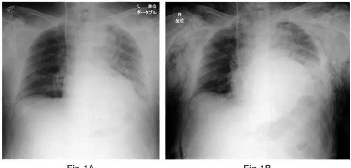 Fig． １A Fig． １B
