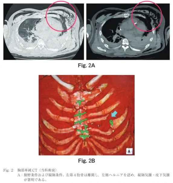 Fig． ３A Fig． ３B