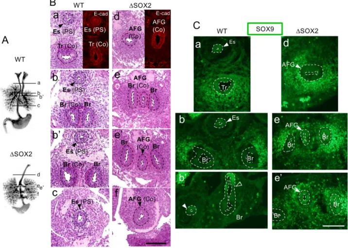 Fig. 1. Absence of the esophagus and expression of NKX2.1 in all epithelial tubes of SOX2-deficient ( Δ SOX2) AFG