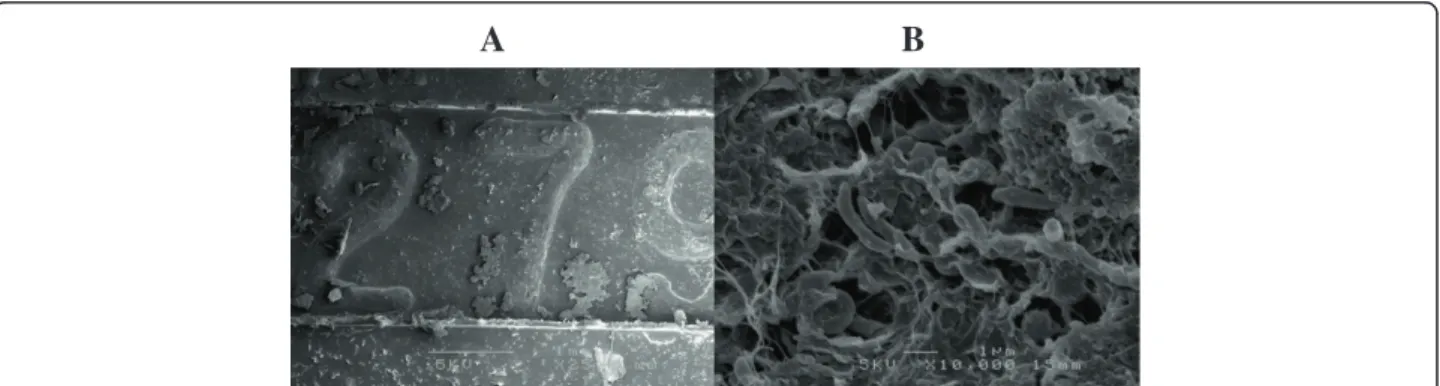 Figure 4 Scanning electron microscopic images of the buckle material. (A) Low magnification