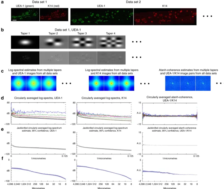 Figure 1 | Intermediate steps in a MiCASA analysis. (a) Representative images of 1-month-old male thymus from a set of ﬂuorescence imaging experiments measuring the same condition