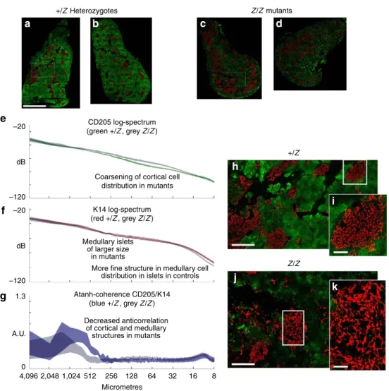 Figure 2 | Analysis of the distribution of cortical and medullary cell populations in control and Foxn1 Z/Z mutant thymus at 4 weeks