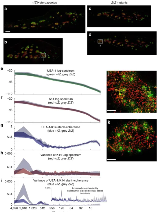 Figure 4 | Analysis of medullary organization in the thymus of Foxn1 Z/Z mutants at 2 weeks