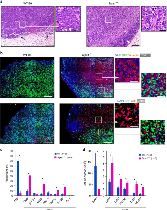 Fig. 6 Marked increase in memory T-cell inﬁltration inside Bcr-Abl + tumors coinciding with increase vimentin high MSCs in Sipa1 −/− mice
